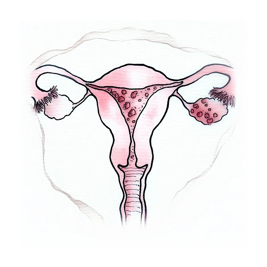 علائم طبیعی بعد از تزریق آمپول HCG در زمان تخمک‌گذاری