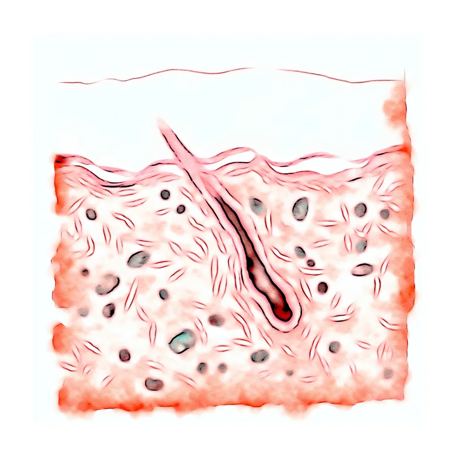 عوارض دمنوش رازیانه برای لک صورت در دختران