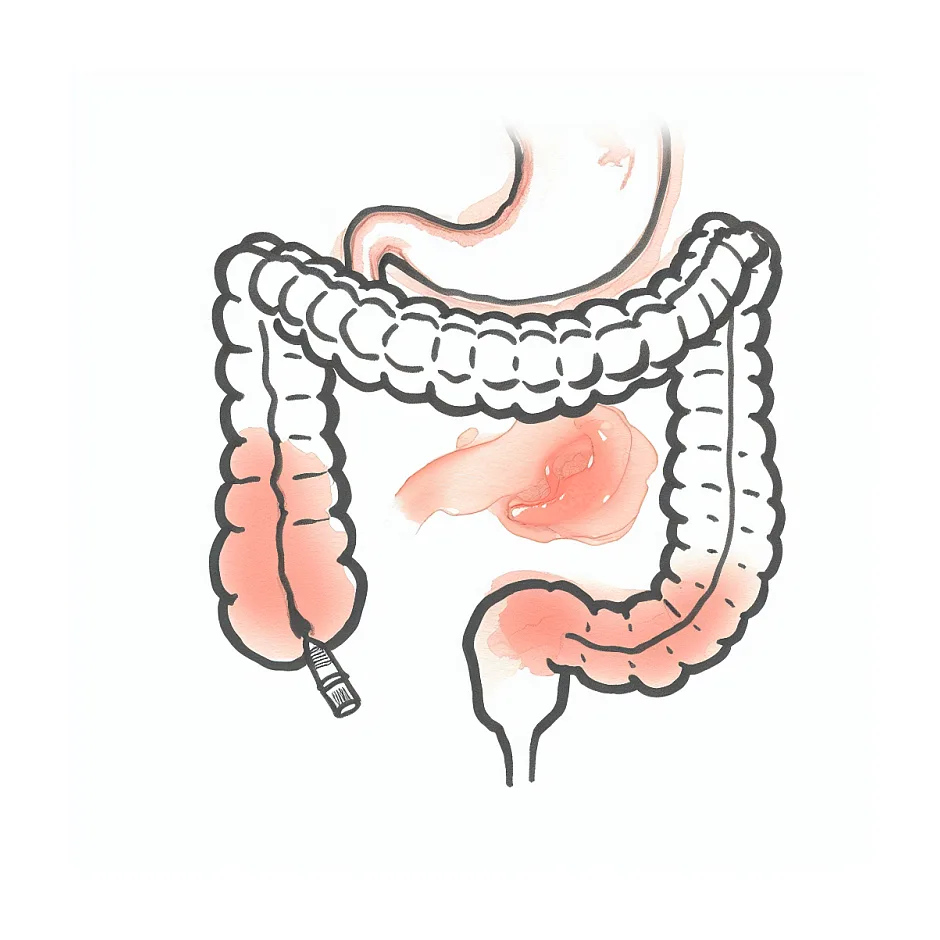 مقایسه شیرخشک نان و بیومیل ای‌آر برای نوزاد