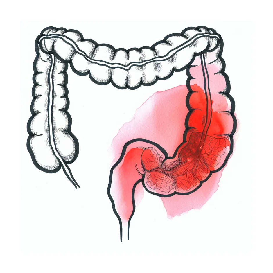 علت درد زیر شکم که به مقعد می‌زند چیست؟