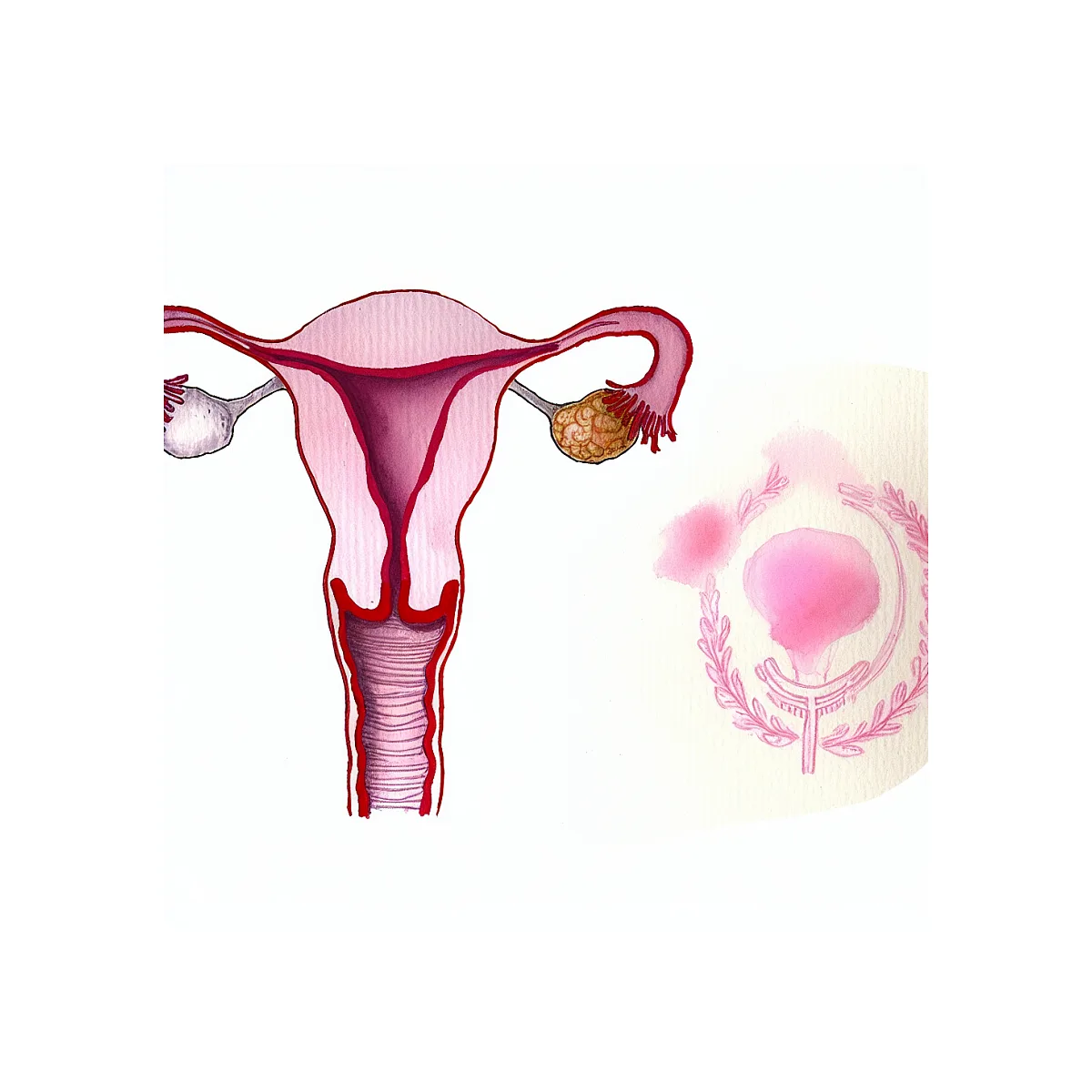 خونریزی حین مصرف مدروکسی پروژسترون طبیعی است؟