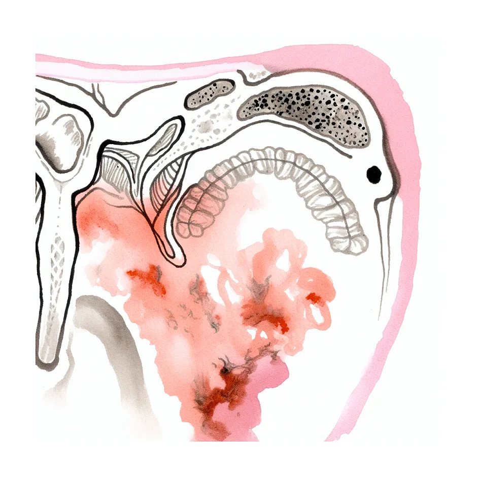 قارچ کشاله ران؛ آیا درمان قطعی دارد؟
