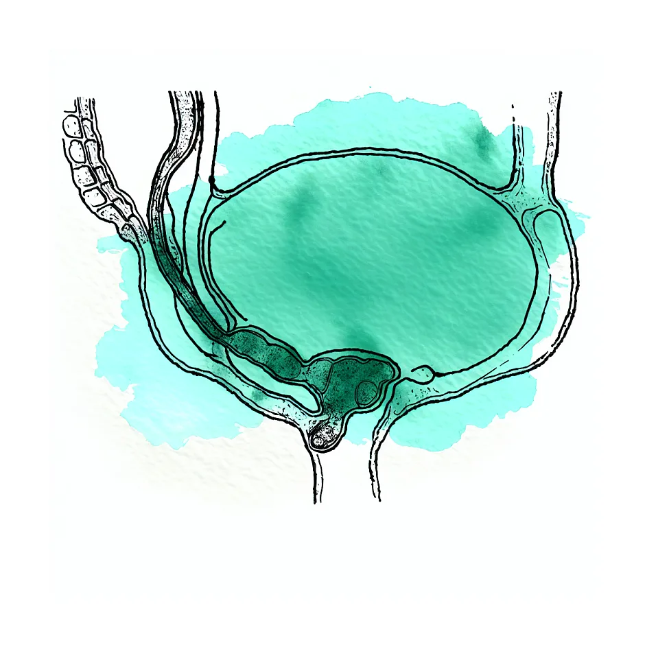 دبری مثانه و تکرر ادرار؛ علت و راه درمان