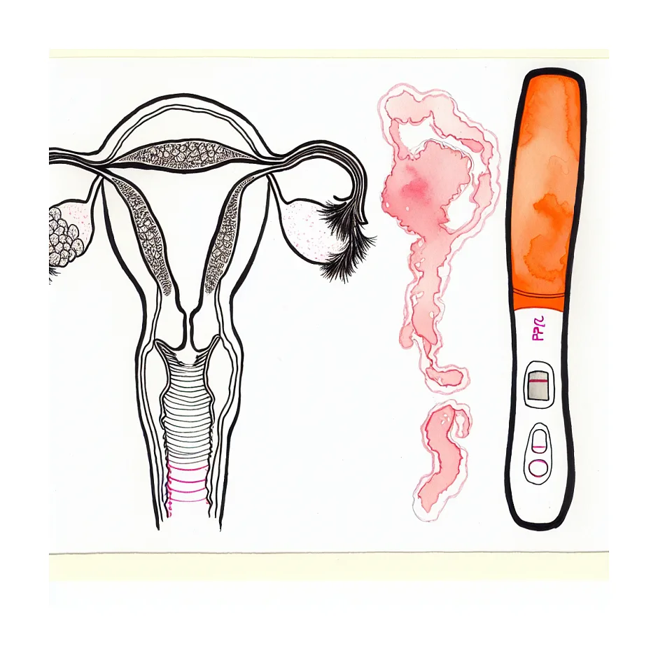 استفاده از کیت تخمک‌گذاری به جای بی‌بی چک بارداری