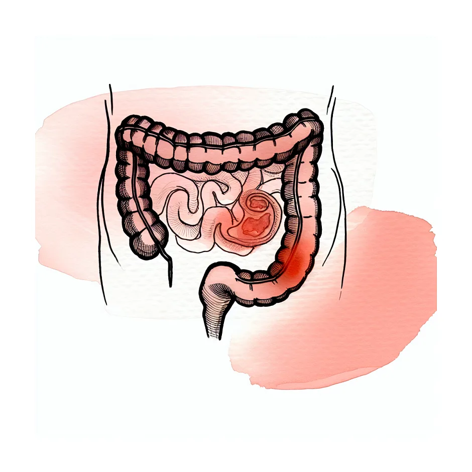 درد دور ناف با استفراغ؛ علل و اقدامات فوری