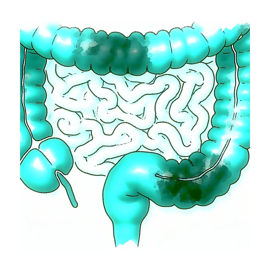 اسهال با مصرف همزمان آزیترومایسین و سفکسیم