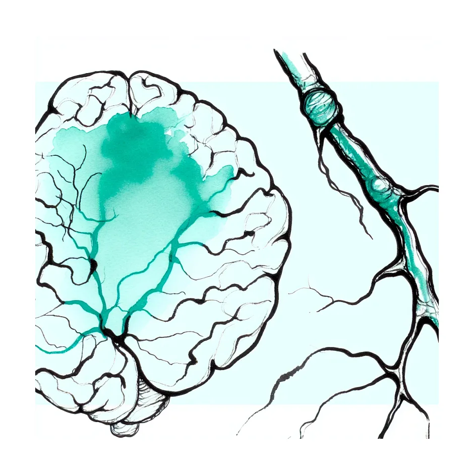 نازک شدن مویرگ‌های مغز؛ آیا خطرناک است؟