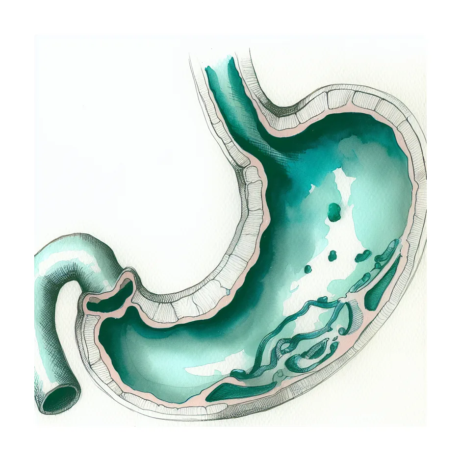 رژیم غذایی مناسب برای ورم معده و رفلاکس