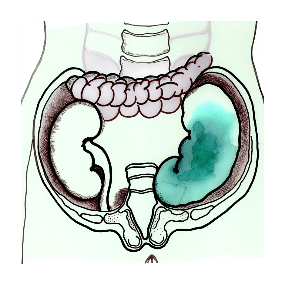 علت دل‌درد و دلپیچه نوجوان ۱۳ ساله
