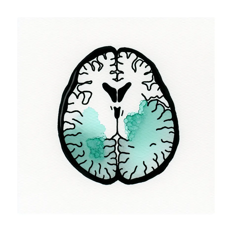 احتمال برگشت از کما ناشی از کمبود اکسیژن مغز — چه عواملی تأثیرگذارند؟