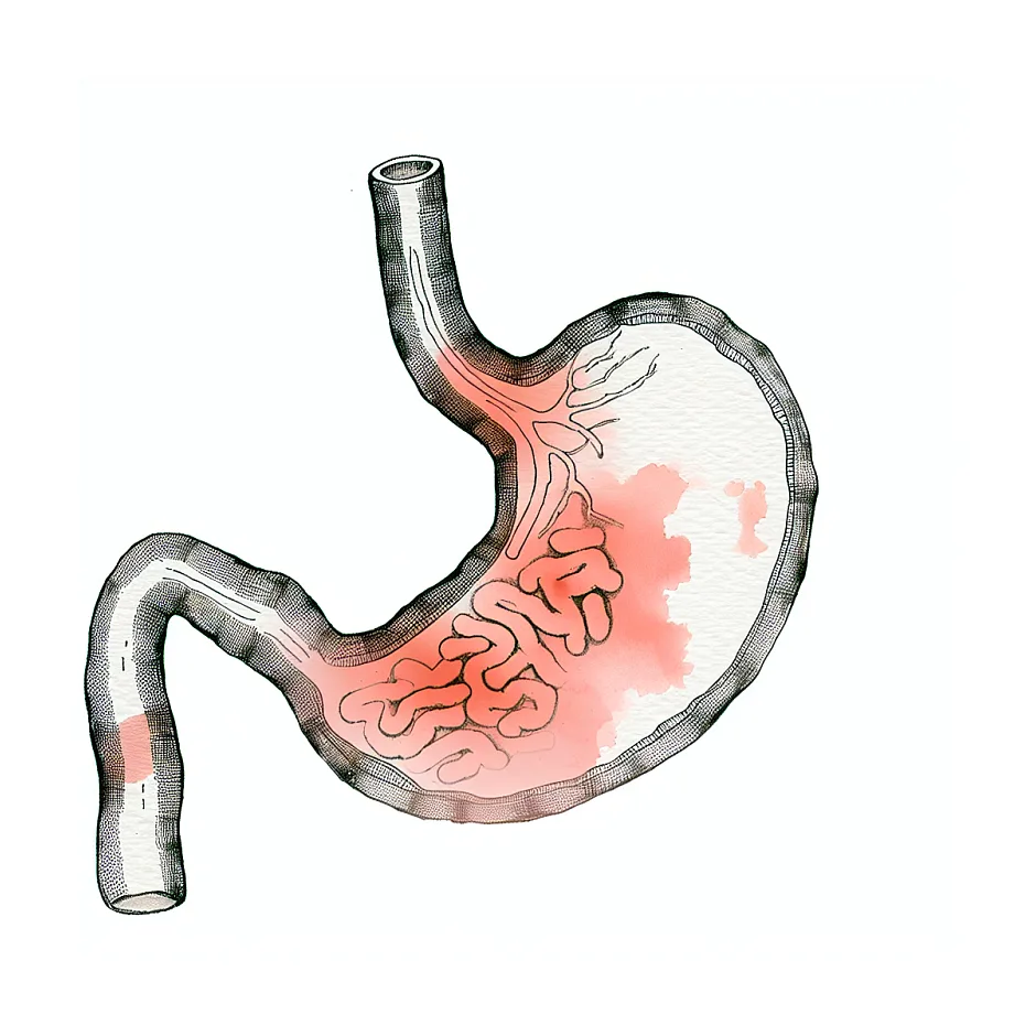 احساس گیر کردن غذا در معده و تهوع؛ سردی معده یا ریفلاکس؟
