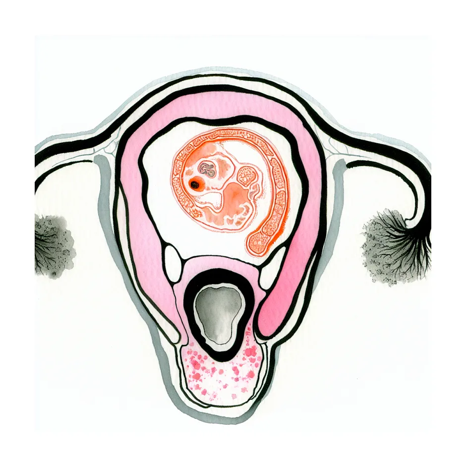 مصرف زرشک در اوایل بارداری و خطر سقط جنین