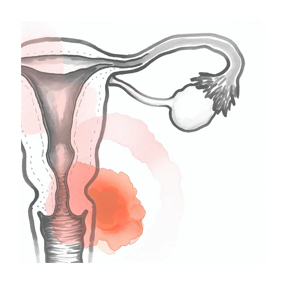 ترشح نارنجی از مقعد در بارداری و مصرف شیاف پروژسترون