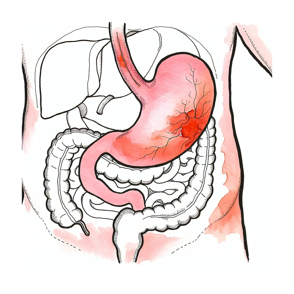علت معده درد بعد از برداشت کیسه صفرا چیست؟