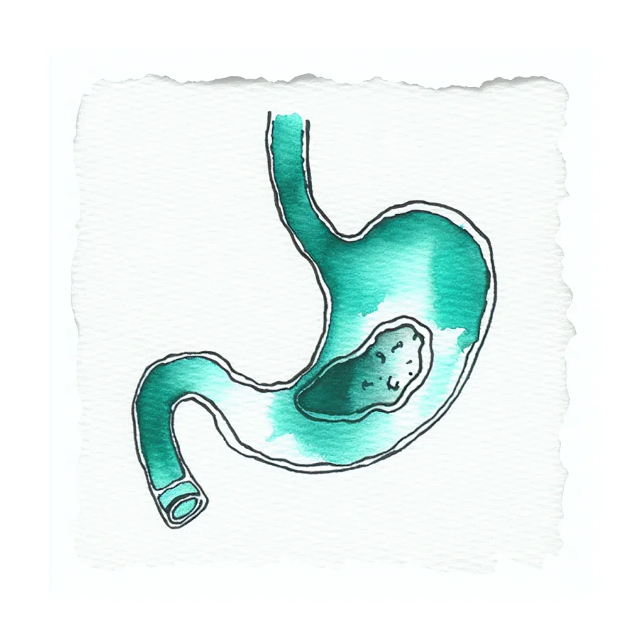 زمان صحیح مصرف شربت معده قبل یا بعد غذا