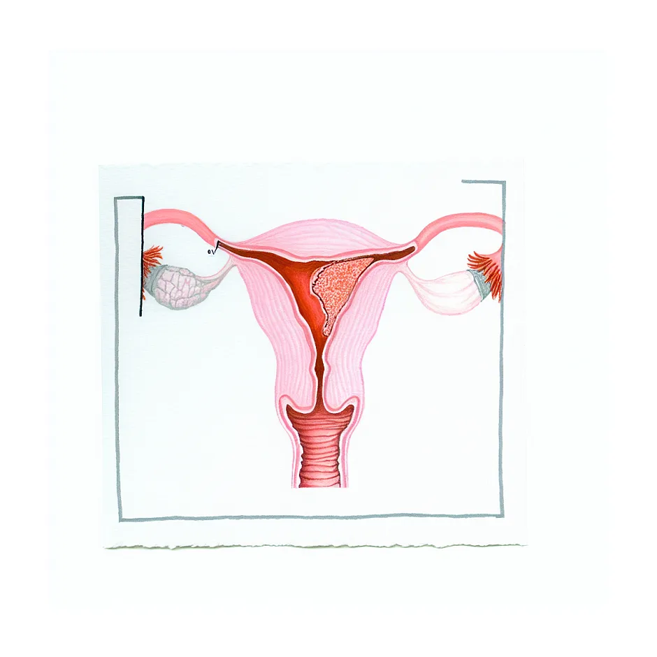 تاثیر قرص اچ دی بر ضخامت دیواره رحم و پریود