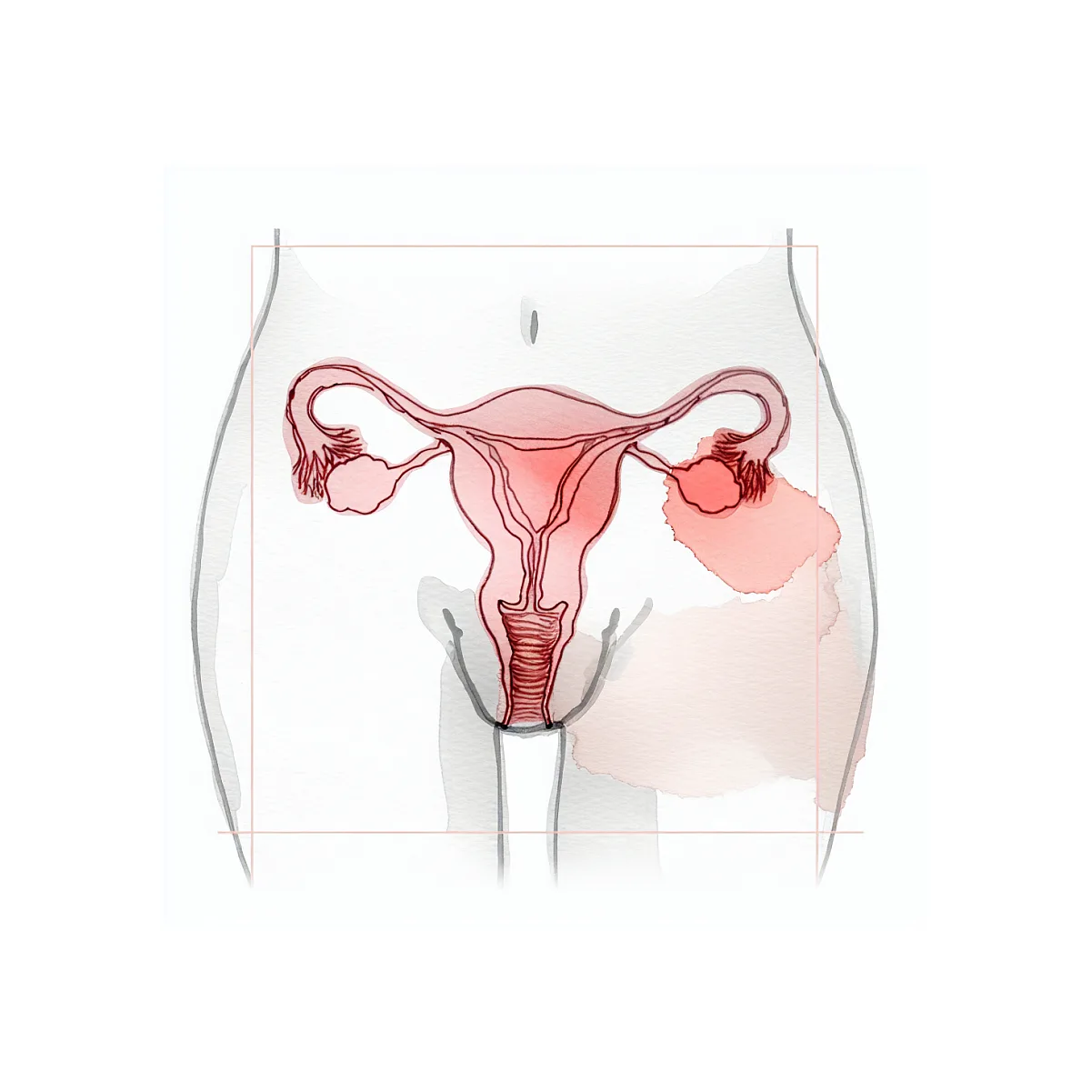 روزه در ماه اقدام به بارداری و مصرف کلومیفن