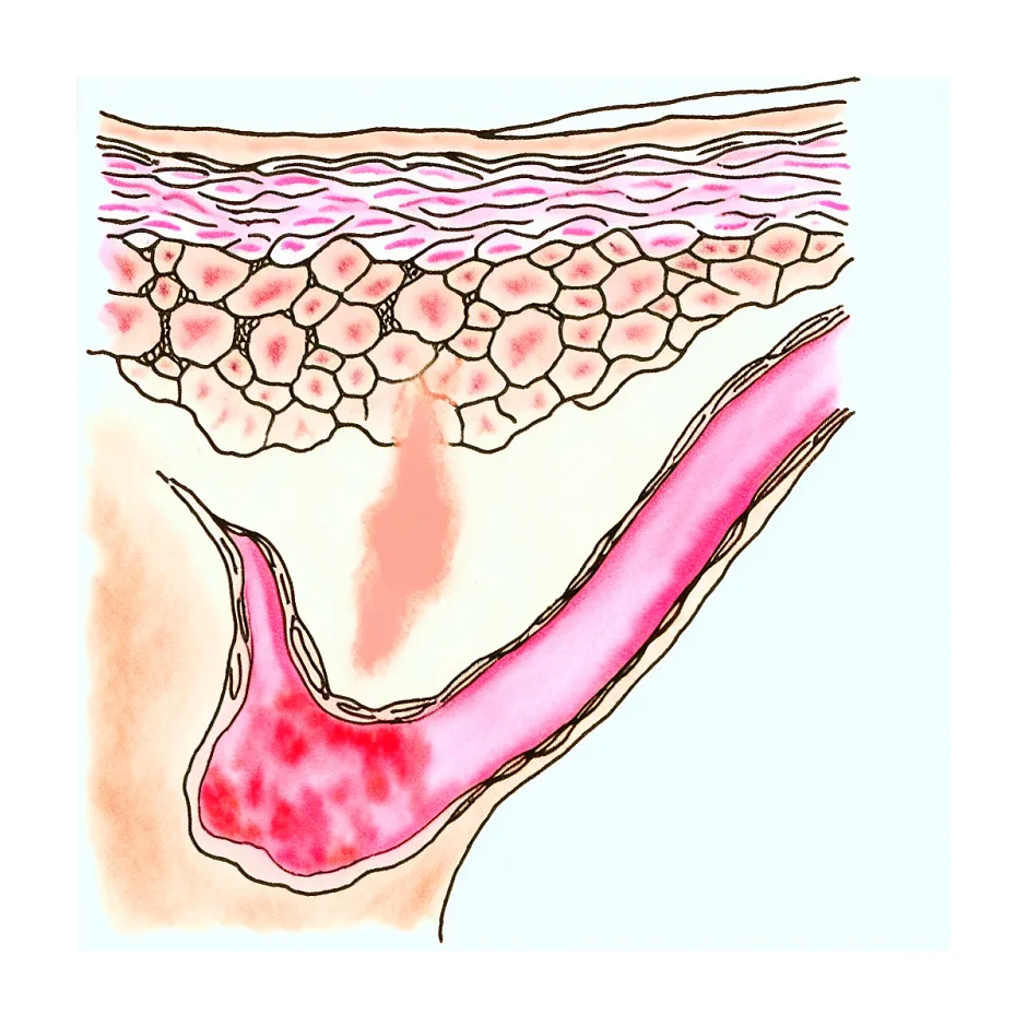 لک پوستی زیربغل مادر؛ آیا نگران‌کننده است؟
