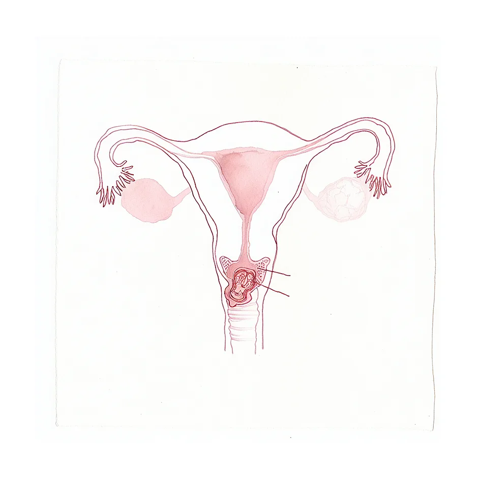 درد شبیه پریود قبل از موعد در حال اقدام به بارداری