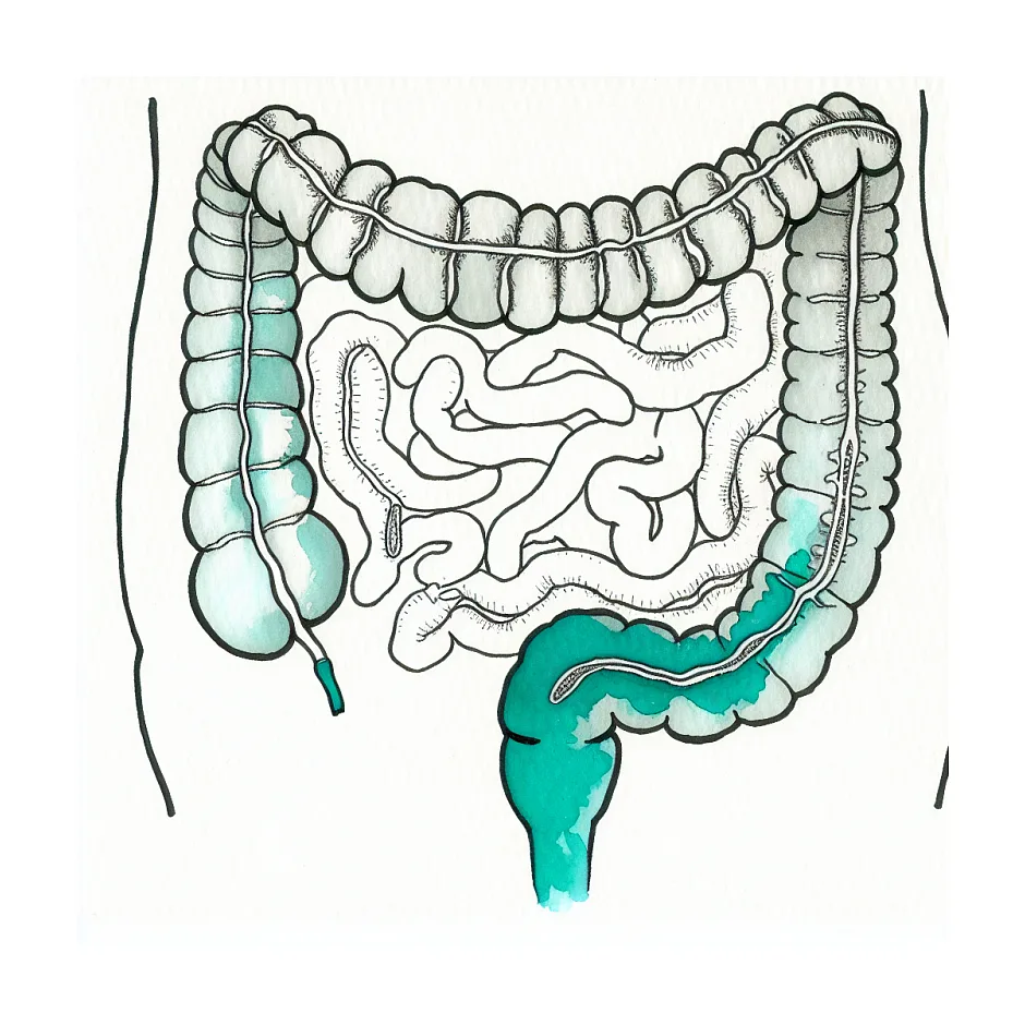 لاغری در سندرم روده تحریک‌پذیر و راه‌های افزایش وزن