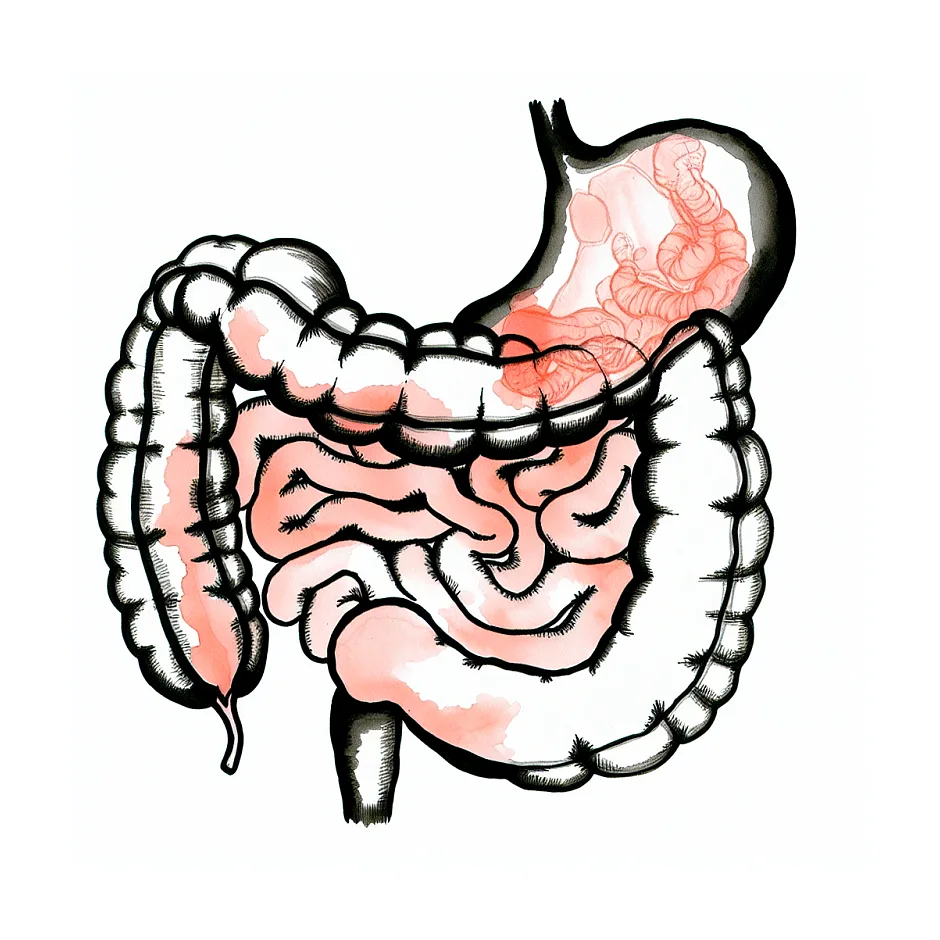 یبوست و نفخ نوزاد با شیر خشک AR و رفلاکس