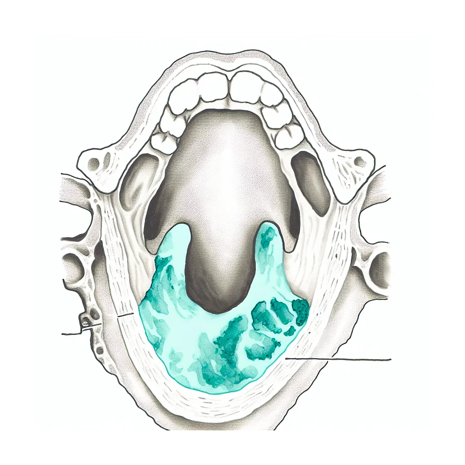 علت خونریزی روز ۵ تا ۷ بعد از عمل لوزه