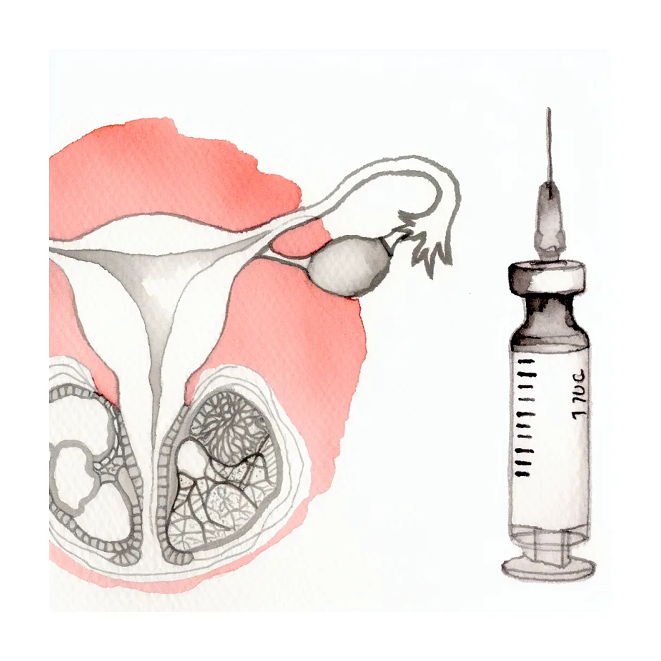 نحوه تزریق آمپول سینال اف در روزهای ۸ و ۹ پریود