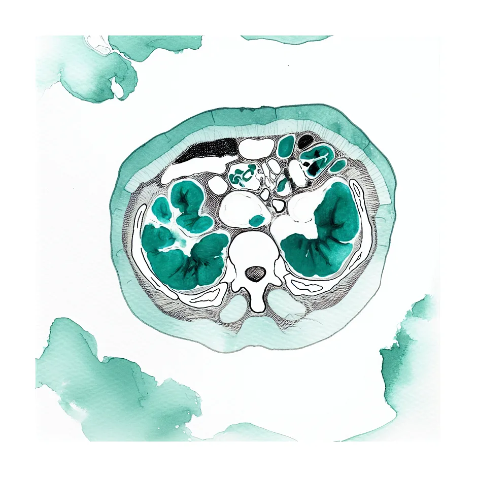 تفسیر نتایج CT Scan - آنالیز چربی بدن
