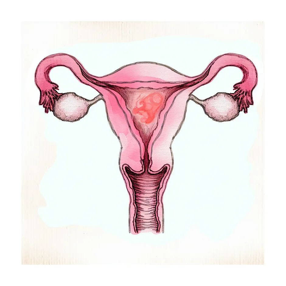 تأخیر پریود بعد از سفیکسیم و مترونیدازول