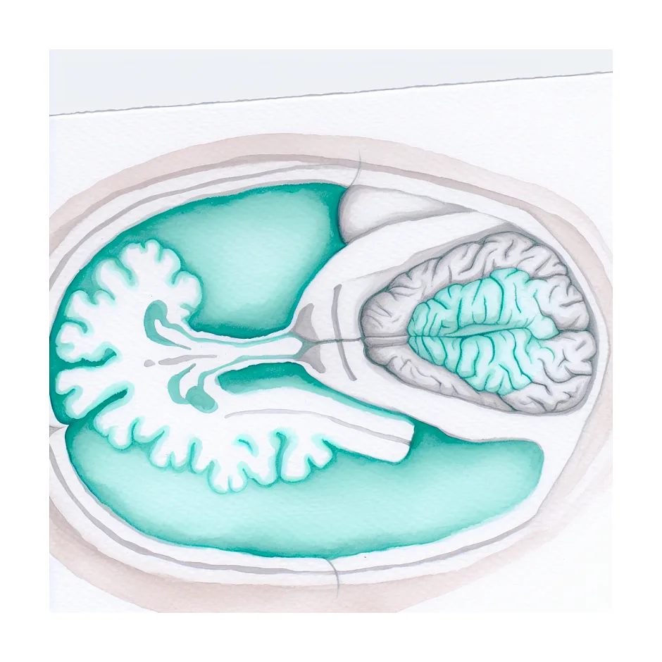 بی‌خوابی بعد از سکته مغزی و راه‌های کمک در منزل