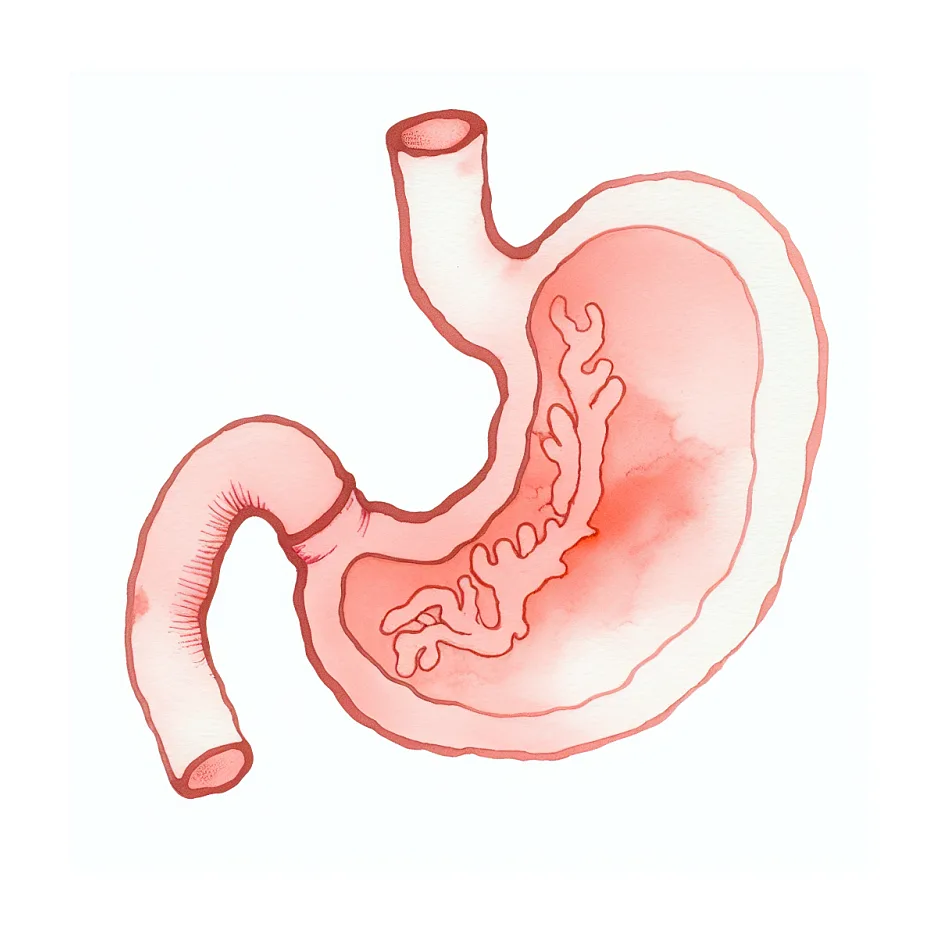 قطره اینفاکول برای کولیک و رفلاکس نوزاد