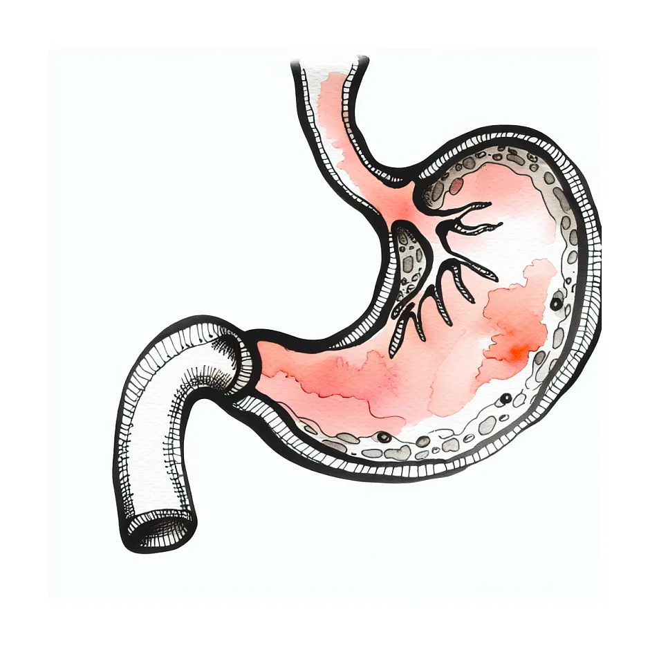 آیا سیپروفلوکساسین و مترونیدازول درد معده را تشدید می‌کنند؟