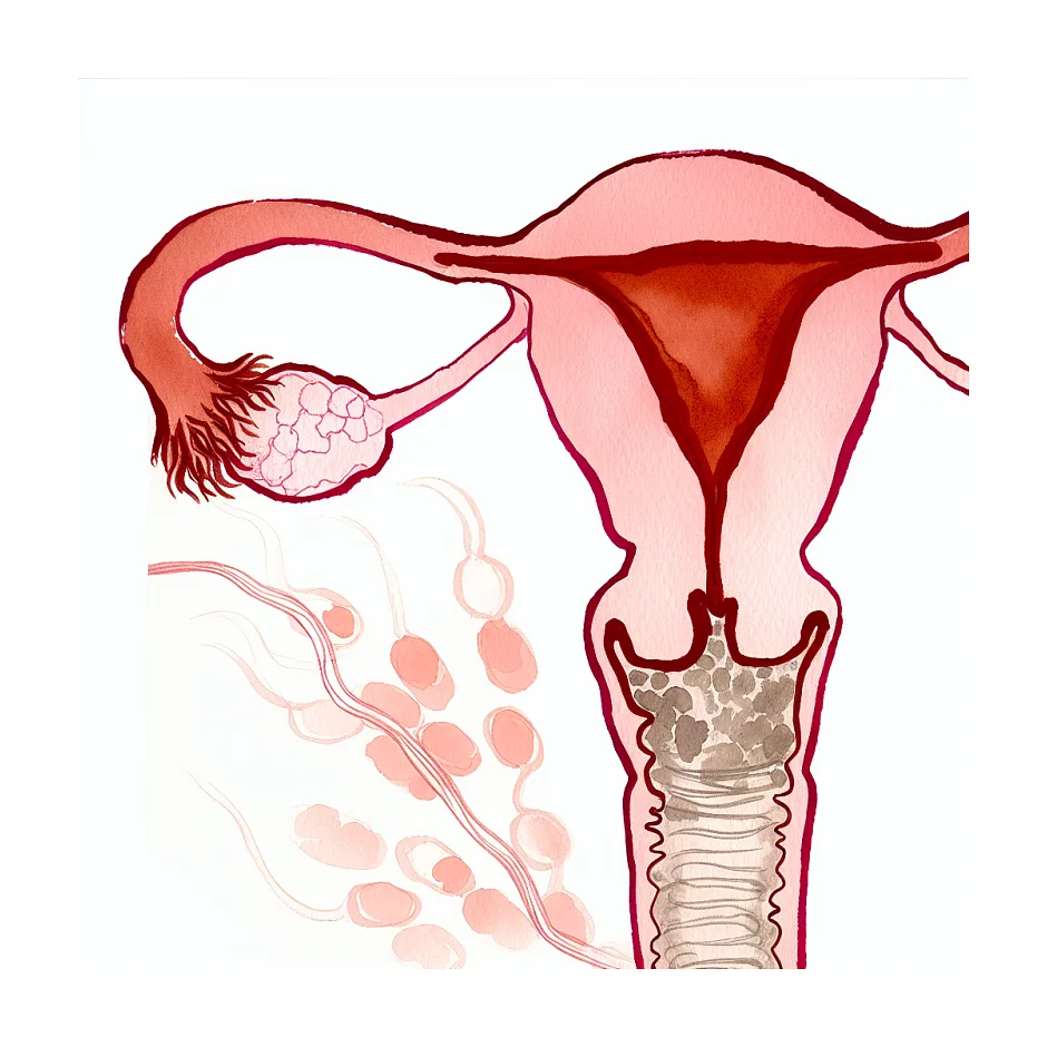 تخم‌مرغ خام و عسل برای تقویت اسپرم و رحم