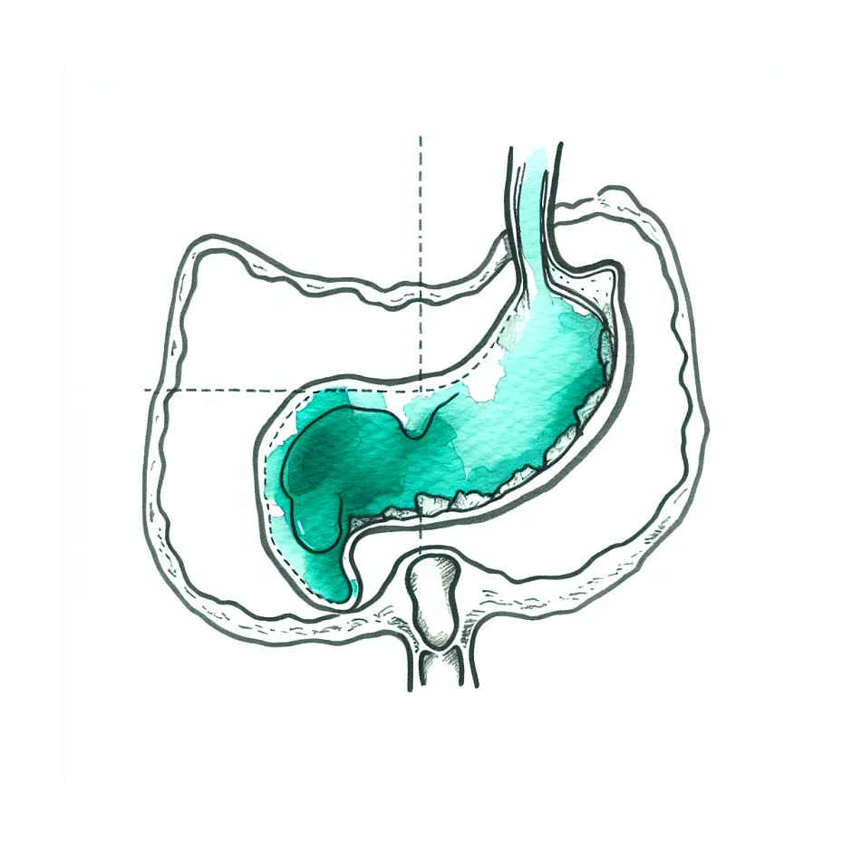 روزه بعد از عمل لاپاراسکوپی کیسه صفرا