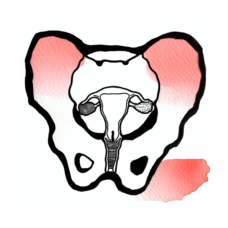 درد رحم و کمر بعد از آمپول HCG و مصرف دوفاستون