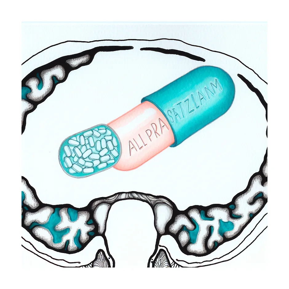 تداخل آلپرازولام و سرترالین؛ آیا خطرناک است؟