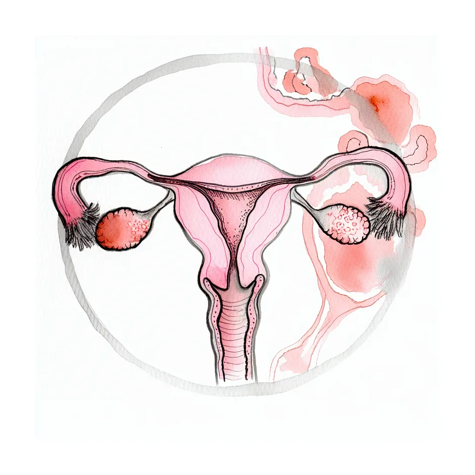 آیا قرص راکوتان (آیزوترتینوئین) باعث عقب‌افتادن پریود می‌شود؟ پاسخ پزشکی و توصیه‌ها