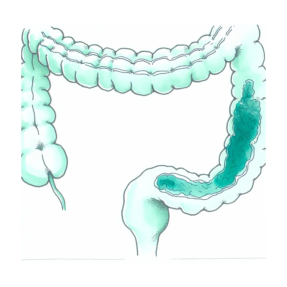 پولیپ آدنوماتوز با دیسپلازی پایین؛ پیگیری و خطر
