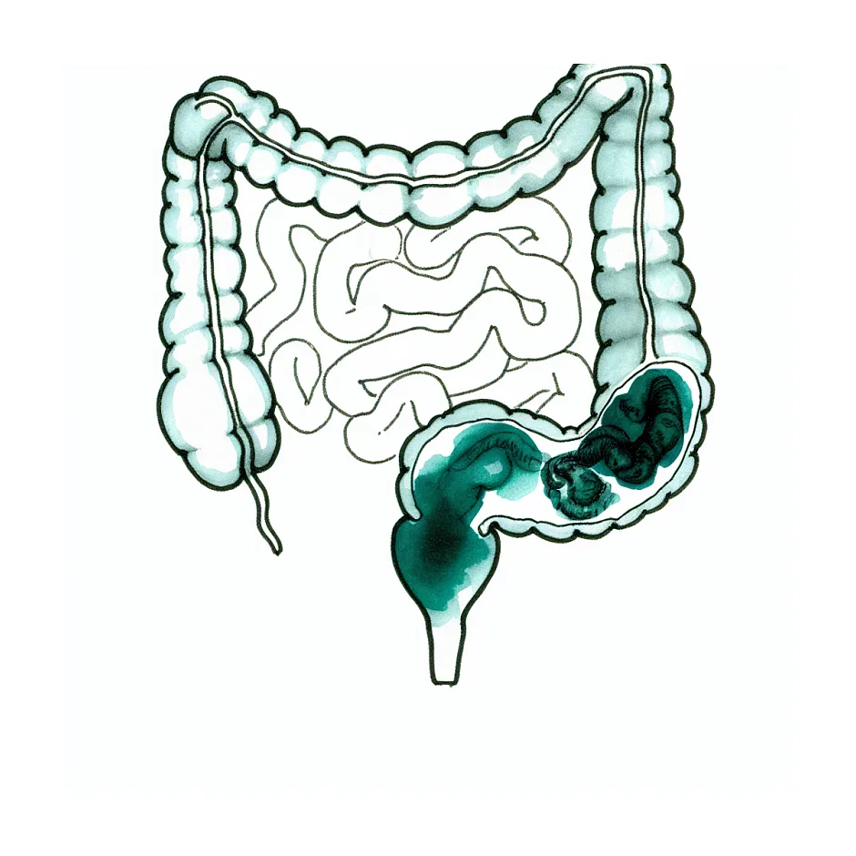علت بوی ترشی مدفوع نوزاد سه ماهه