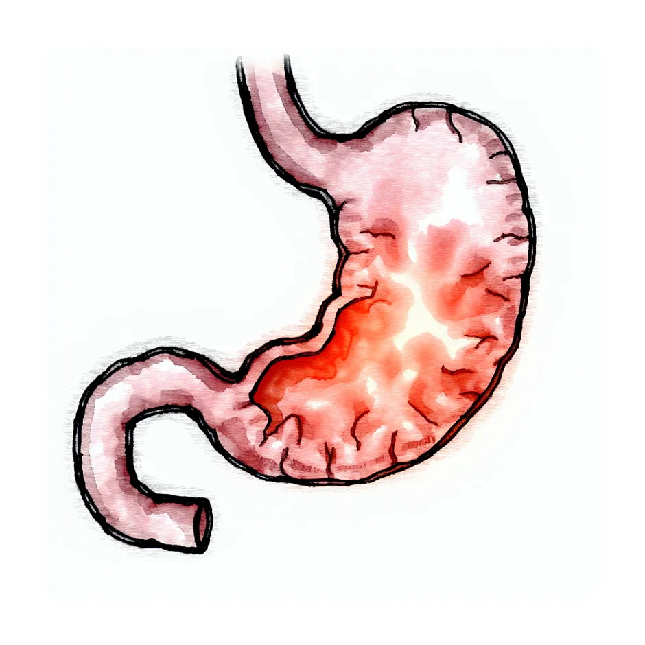 علت داغ شدن معده و سرمعده بعد از غذا