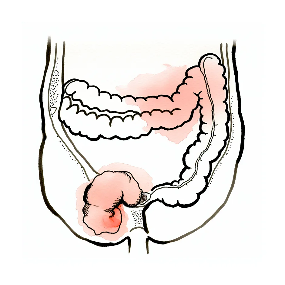 آیا آپتامیل پپتی باعث یبوست نوزاد می‌شود؟