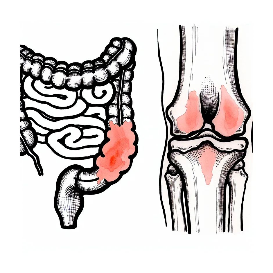 درد شدید مفاصل در کولیت روده — نشانه چیست؟