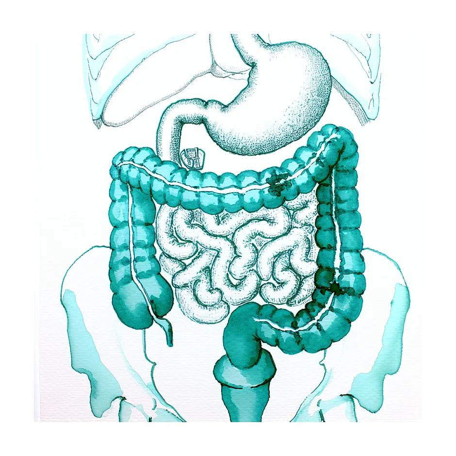 علت مدفوع شل و آبکی نوزاد سه ماهه