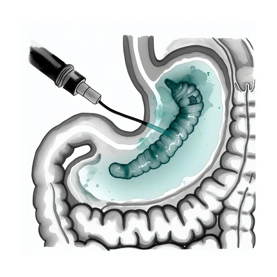 آیا آندوسکوپی بدون نمونه‌برداری هلیکوباکتر را نشان می‌دهد؟