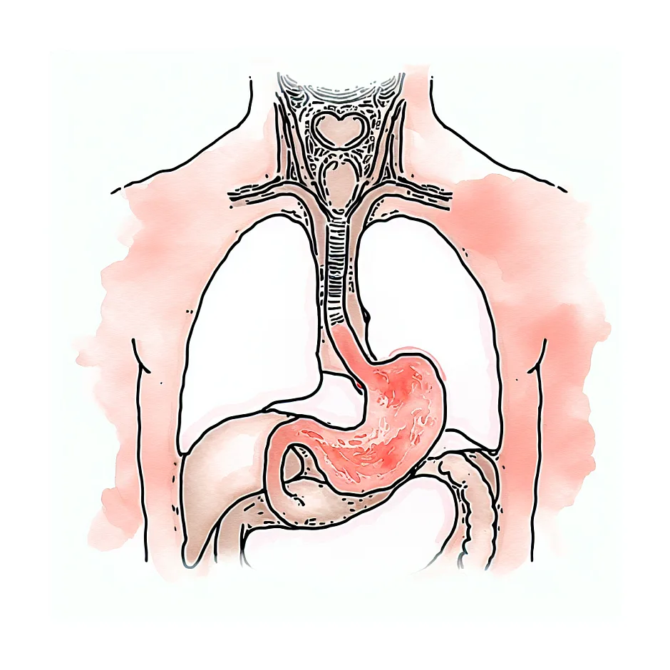 درد قفسه سینه بعد از مصرف تاوالاسین