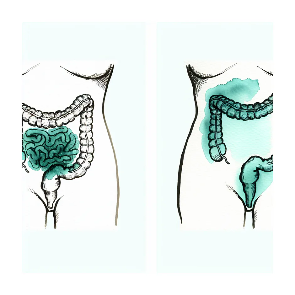 دل‌پیچه و اسهال بعد از سزارین، طبیعی است؟