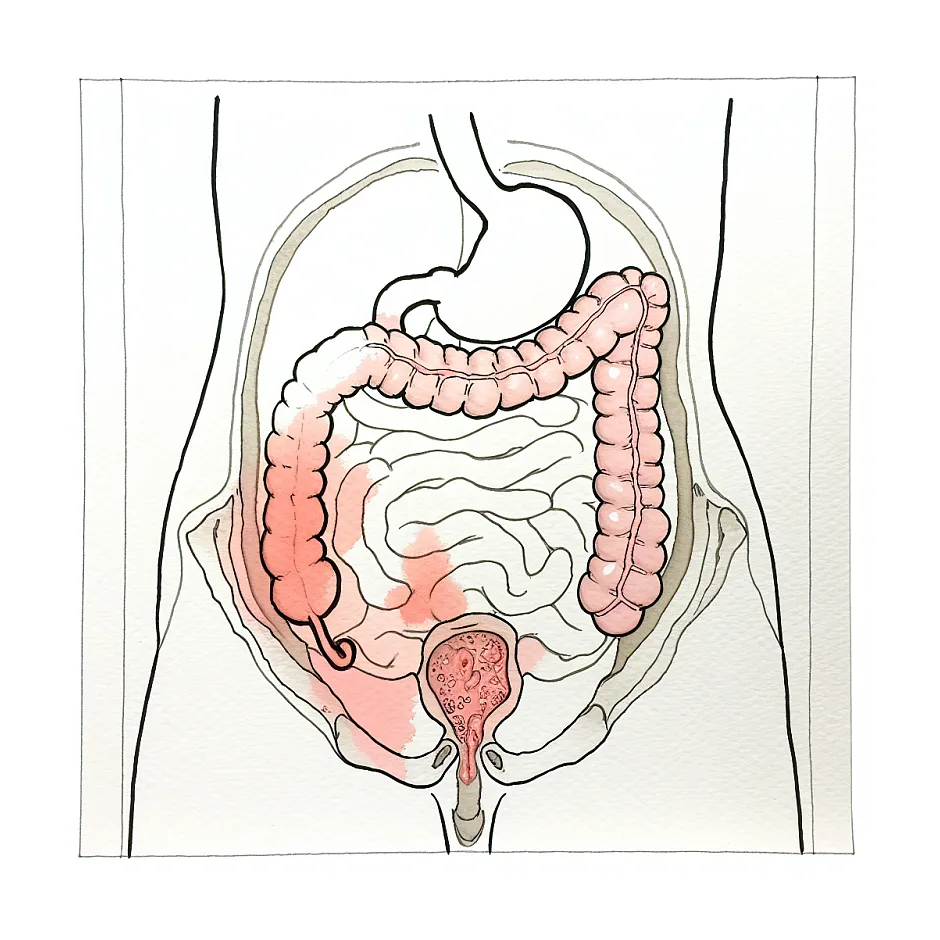 عوارض شیر خشک و کولیک در نوزاد یک ماهه