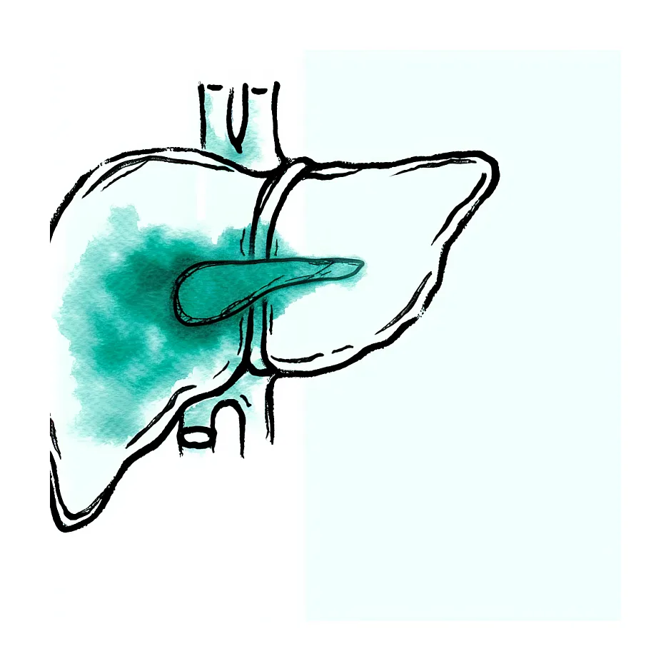 لکه روی کبد در سی تی اسکن؛ آیا نیاز به biopsy هست؟